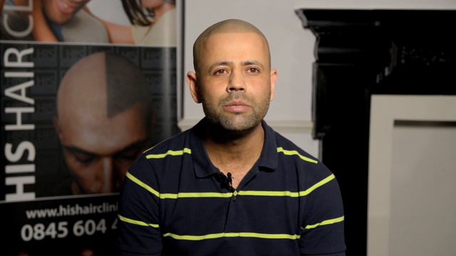 Naz's Hair Loss Treatment carried out by HIS Hair Clinic (complete) смотреть онлайн