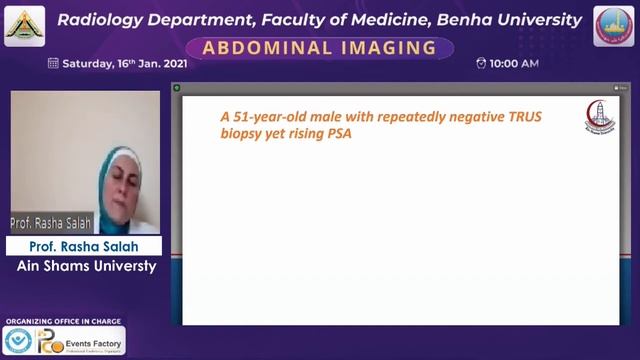 Prostste Cancer imaging смотреть онлайн