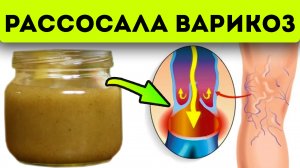 Нанесла это на ногу и сразу ушёл весь варикоз! Домашняя мазь от варикоза из...