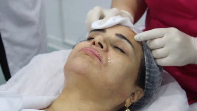 Kimyəvi pilinqlər ilə master-klass. Мастер класс по химическим пилингам смотреть онлайн