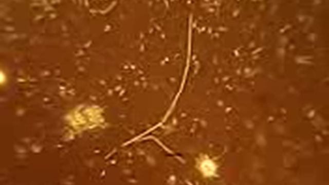 Бактерии палочки под микроскопом смотреть онлайн