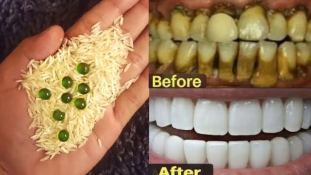 comment Rendre les dents jaunes, sales ,pourries blanches brillantes comme des perles avec du riz смотреть онлайн