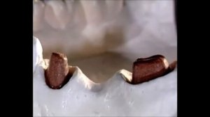 Металлокерамический мост  Как изготовить металлокерамический мост  Ортопедическая стоматология