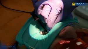 Апекслокатор BINGO PRO (Бинго Про) для стоматологов. Пошаговая инструкция по применению