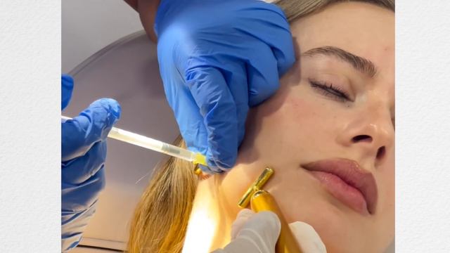 The truth on how I changed my face shape 🎀 ✨JAW BOTOX ✨🎀 смотреть онлайн