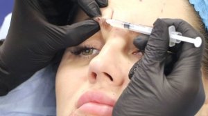 Обучение инъекциям ботокса