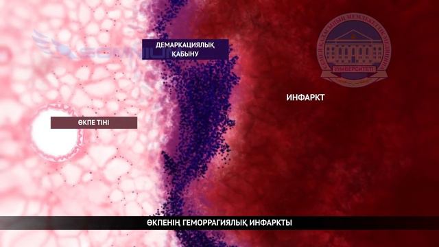 M044   Некроз және апоптоз
