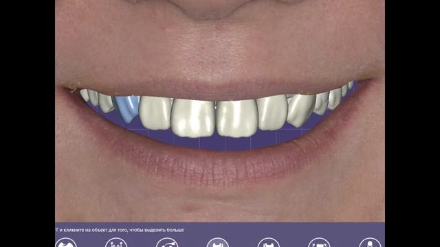 3д моделирование улыбки