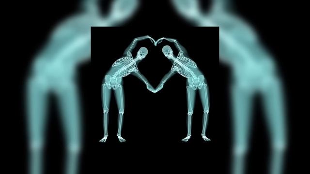 Childish Gambino - Do Ya Like X Resonance (sped Up)