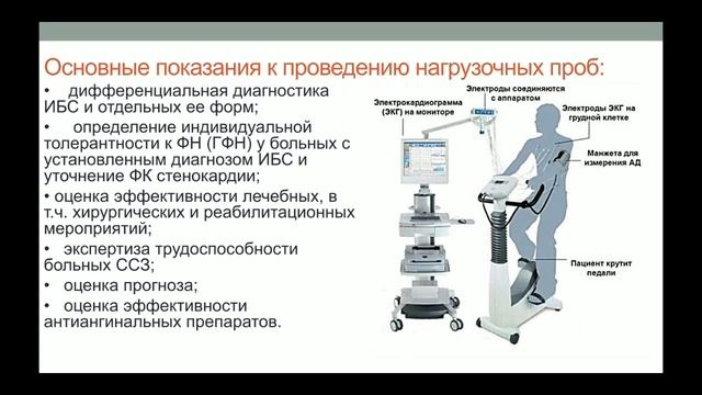 Атеросклероз. ИБС. Стенокардия напряжения (стабильная стенокардия). Часть 2. смотреть онлайн