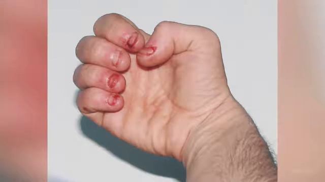 ЧТО БУДЕТ, ЕСЛИ ГРЫЗТЬ НОГТИ!