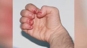 ЧТО БУДЕТ, ЕСЛИ ГРЫЗТЬ НОГТИ!