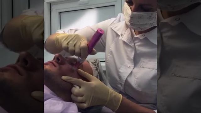 фракционная мезотерапия с помощью дермапена смотреть онлайн
