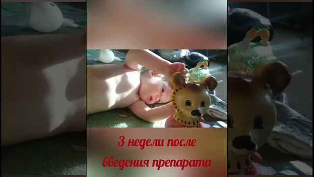 До/после и олимпийские успехи смотреть онлайн