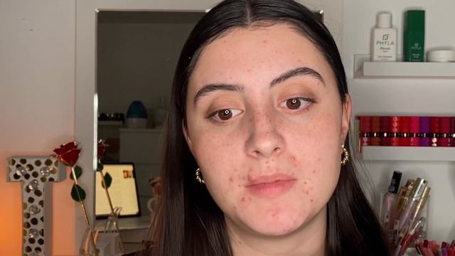HOW TO GET RID OF ACNE SCARS AT HOME WITH MICRONEEDLING | Banisher Tutorial смотреть онлайн