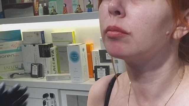 Увеличение подбородка филлером на основе ГК. смотреть онлайн