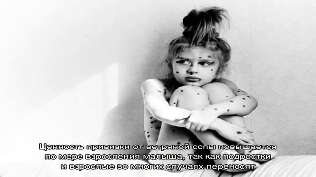 Как заболеть ветрянкой? смотреть онлайн