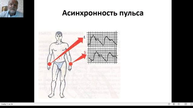 Исследование пульса. Вводная лекция смотреть онлайн