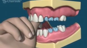 К чему приводит сосание пальца и как это исправить