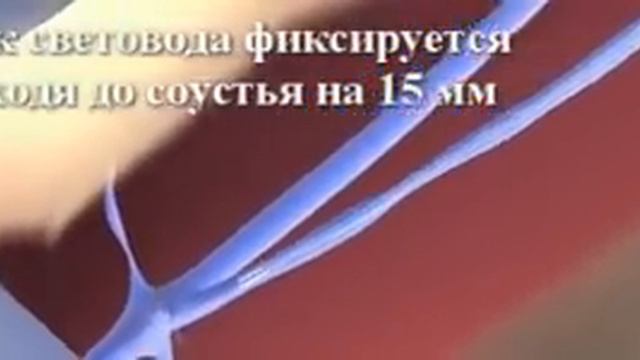 ЭВЛК в 3D смотреть онлайн