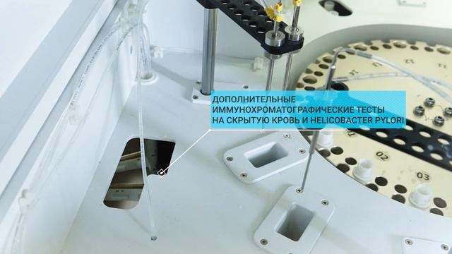 Автоматизация анализа кала с помощью SCIENDOX 2000R и алгоритмов искусственного интеллекта смотреть онлайн