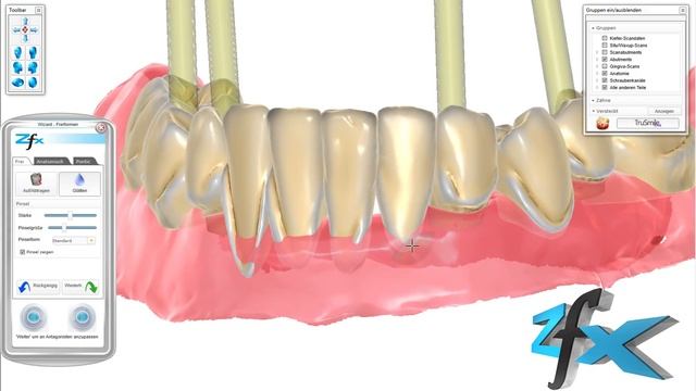 Zfx CAD Software - Toronto Bridge смотреть онлайн