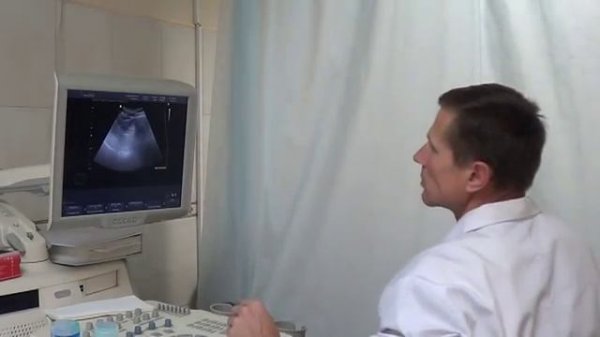 Узи кишечника.mp4