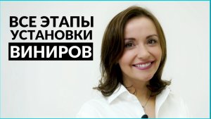 Как устанавливают виниры на зубы? Все этапы установки виниров. InSmile