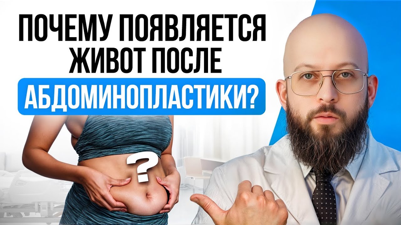 ВЕРНЕТСЯ ЛИ ЖИВОТ ПОСЛЕ АБДОМИНОПЛАСТИКИ? | ПОЧЕМУ ПОЯВЛЯЕТСЯ ЖИВОТ ПОСЛЕ АБДОМИНОПЛАСТИКИ? смотреть онлайн
