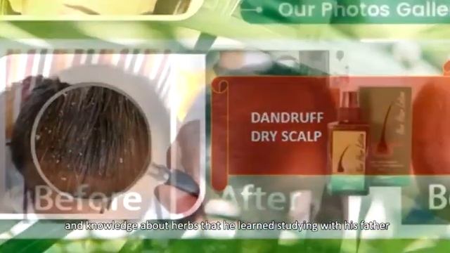 Dexe anti hair loss shampoo, Neo Hair Lotion and Hair Nara смотреть онлайн