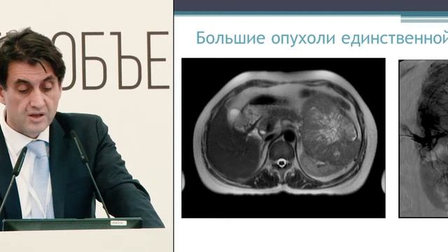 Онкоурология. Чего мы добились за 20 лет и куда идем? Хирургическое лечение смотреть онлайн