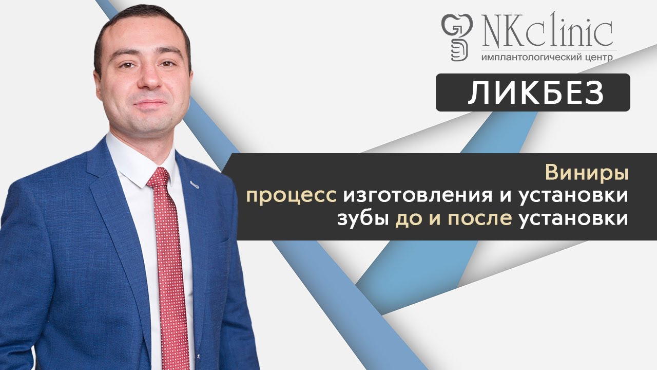 Виниры. Процесс изготовления и установки. Зубы до и после установки виниров | Блог #11 | NKClinic