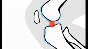 Хондроксид гель