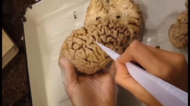 Анатомия человека Мозг смотреть онлайн