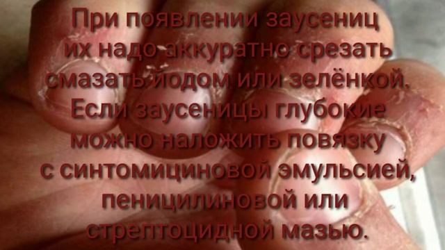 Как предохранить ногти от загрязнения,во время работы на огороде!☝️? смотреть онлайн