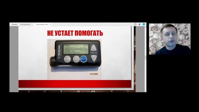 Инсулиновая помпа за и против. смотреть онлайн