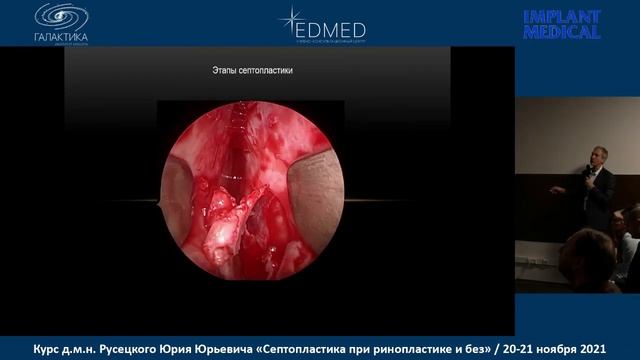 Лекция: Push Down по Коттлу и его модификации смотреть онлайн