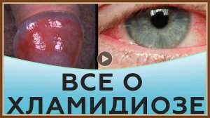 ХЛАМИДИОЗ - ПРИЧИНЫ СИМПТОМЫ ЛЕЧЕНИЕ.mp4