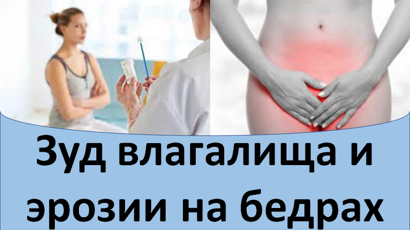 Зуд влагалища и эрозии на бедрах смотреть онлайн