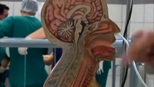 Procedimiento para la colocación de sonda nasogastrica. смотреть онлайн