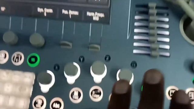 GE Voluson E8 Knobology смотреть онлайн