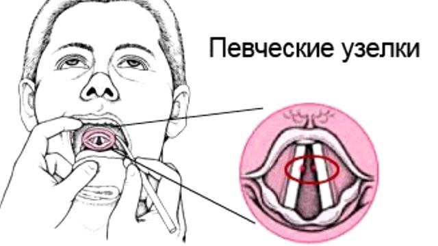 Лор. Фониатр.