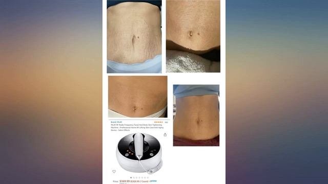 MLAY RF Radio Frequency Facial And Body Skin Tightening Machine - Professional Home review смотреть онлайн