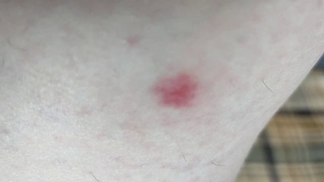 Kalisci CARICH Mosquito Bite Противозудное средство от укусов насекомых (15 мл) смотреть онлайн