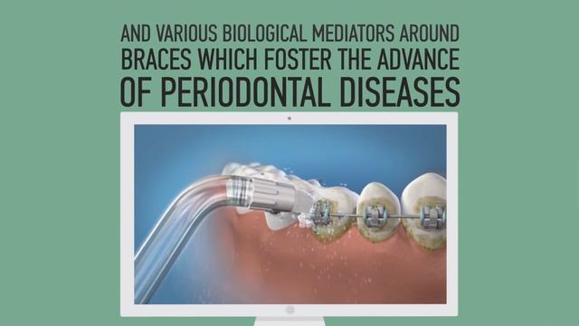 Got Braces? It's Easier to Clean & Floss with a Waterpik™ Water Flosser смотреть онлайн