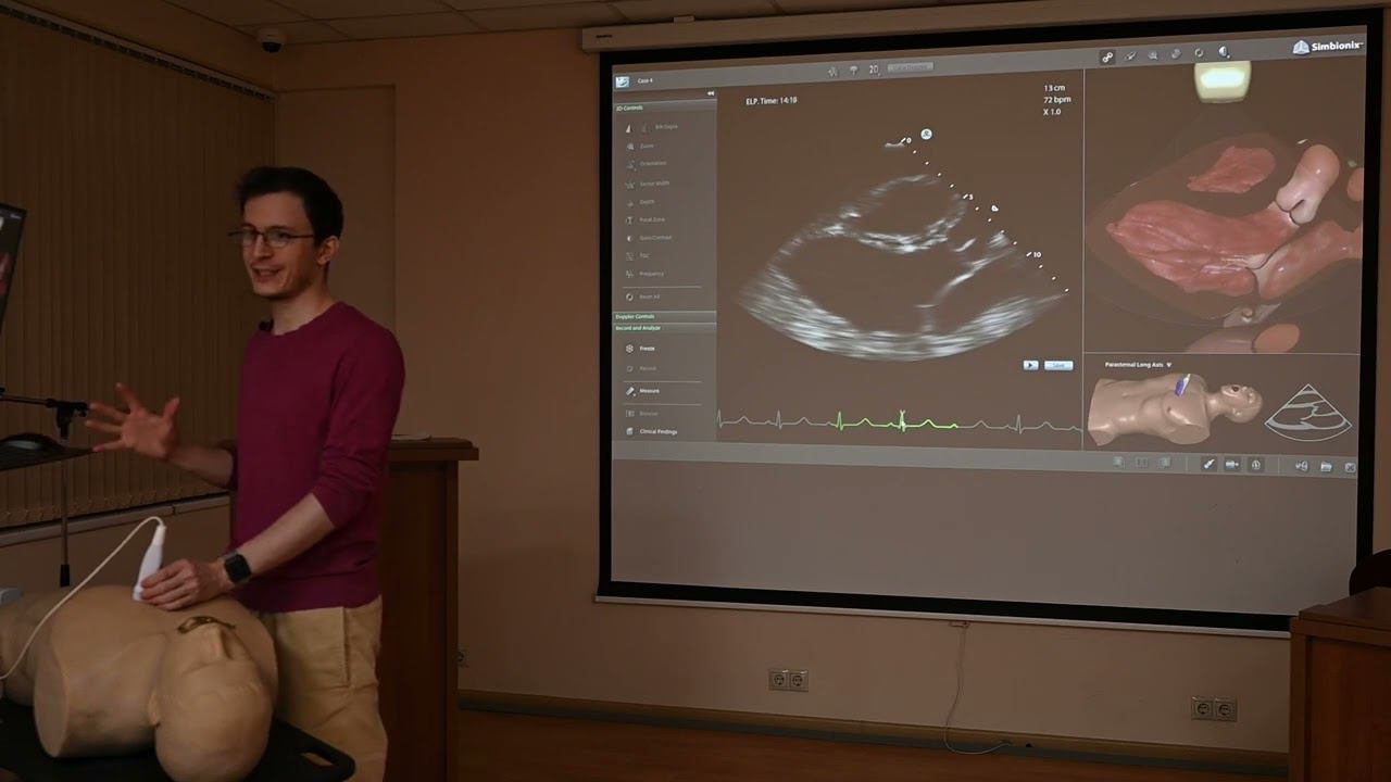 Эхокардиография. Занятие 15: Оценка диастолической функции левого желудочка смотреть онлайн