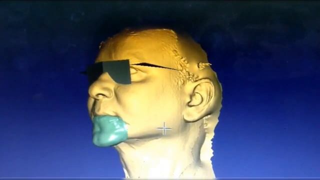 Exocad chin prosthesis смотреть онлайн