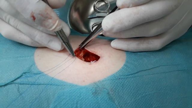 Фотоэпиляция: безопасность и эффективность в одной процедуре