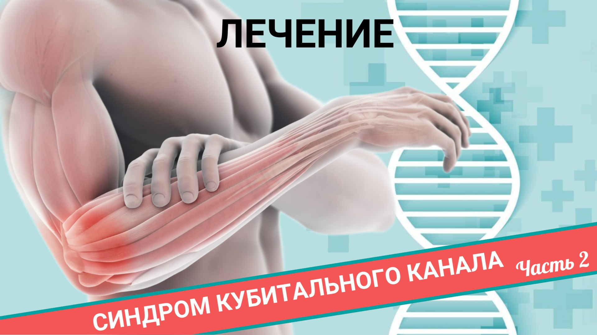 СИНДРОМ КУБИТАЛЬНОГО КАНАЛА. ЛЕЧЕНИЕ. (Часть 2) смотреть онлайн