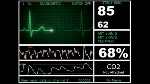 Кардиомонитор | Пульс | Ритма сердечного слежение